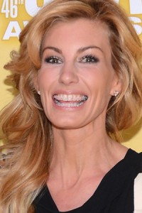 Faith Hill has adult orthodontic braces