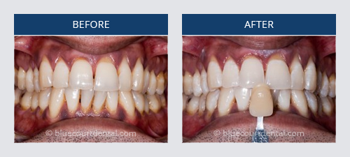 case study