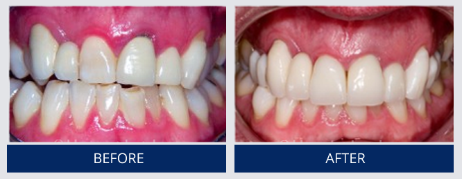 Mini Smile Makeover Case